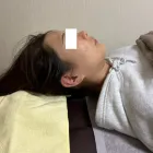 リフトアップ